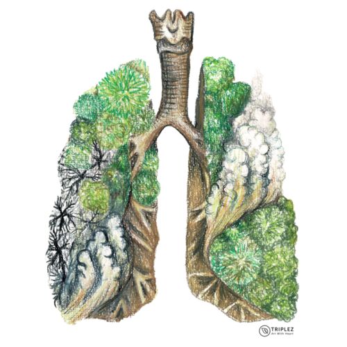Amazon Lungs NEW Thumbnail